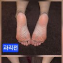 The고운스킨케어