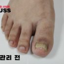레푸스 사상점 이미지