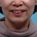 부평안치과의원 이미지