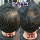 큐 (Q)사랑 이미지