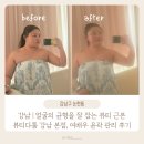 (주)웰솔루션 | 강남 | 얼굴의 균형을 잘잡는 뷰티의 근본, 뷰티다룸 강남본점 여배우 윤곽 관리 후기