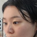 알엑스더마 "덱스텔라 AC크림" 솔직한 후기(+ 여드름성피부, 지성피부 크림 추천, 진정&amp;보습)