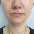 메디엘 | 🌟 피부 속까지 비타민 충전! 메디엘 실크플럭스 C33 세럼 리얼후기 🌟