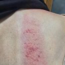바른자세바디케어운동센터 네이버블로그