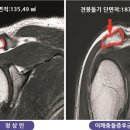 본튼튼마취통증의학과의원 네이버블로그