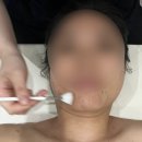 청라피부관리 뷰티팬지에스테틱 ‘레틴-오일필’ 솔직 후기