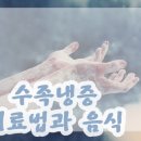 르칼피아 이미지