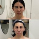 예쁠,미 네이버블로그