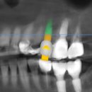애플치과기공소 이미지