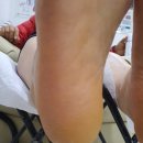 페디네일 이미지