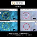 고운빛의원 티스토리