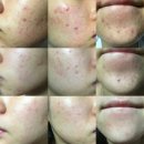 라 벨르 에스테틱 이미지