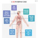 아나필락시스 쇼크 에피네프린 주사 아낙필락시스 이미지