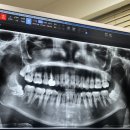 드림라인치과교정과치과의원 | 77ㅑ 새로운 이🦷생을 찾다! (부분교정 MTA 약 6개월 착용+서울매스티지치과 후기)