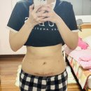 오렌지케어 | 복부지방추출주사 결혼다이어트 3주차 오렌지 케어 중저주파 후기 (통증, 멍, 붓기)