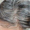 닥터로나 | 닥터그루트 샴푸 내돈내산 한달 후기