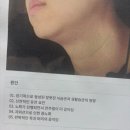 신에너지 | 부산 올타이트리프팅 착붙 400샷 후기, 이중턱과 볼처짐 고민으로 받아본 솔직 리뷰