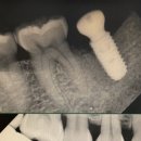 연세메이트치과의원 이미지