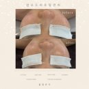 뷰티앤뉴 (Beauty & Nutri) | 케어 하나로 다섯마리 토끼 잡는 업모드 리프팅관리 김해 피부관리블랑뷰티