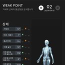 이상우피지오그램