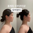 통일로JC 주변도로 | 홍제동피부관리 모어뷰티 광채 피부결 회복 후기