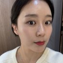 세포 | 남포동 리쥬란잘 하는 곳 (feat. 관자 필러, 줄기세포) 찐 후기