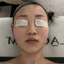 보노뷰티 | [남양주 마석] 화도 피부관리 '더윤뷰티' 보노필 데콜테 만족 후기