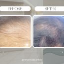 (주)강남셀바이오뱅크 | &#34;강남부터 전국으로 확산 중인 ‘두피 탈모 케어’ 비법&#34; -(주)나와모랩 영등포 1호점