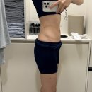하프라인 | 수원 비만클리닉 찾다 지방분해주사 받고 허리라인 하프해진 후기