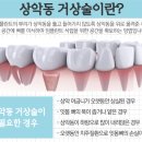 에스프라임 이미지