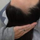 경안동 154-6 | 경기광주 두피문신 추천!! 경안동 블랙톡톡 두피커버후기