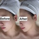 덕산경찰서 옆 | [거제/옥포] 거제 옥포동 거제피부관리 웨딩신부관리로도 추천하는 웨이브온다 리프팅 관리 에스테틱샵...