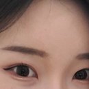 옳은손성형외과의원 이미지