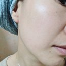 셀네오 | EGF재생크림으로 트러블 흔적 지우기! 네오메틱 리젠셀 크림 리얼 후기
