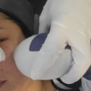 간편한의원 | 강남리프팅 튠페이스 솔직 후기 짧은 시간 간편한 리프팅 내돈내산