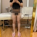 성복동에스테틱 하체 부종 완화 &amp; 바디라인 관리 [더플로라에스테틱]