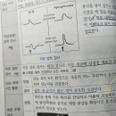 선천성거대결장 엑스레이 이미지