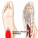 발뒤꿈치 찌릿찌릿 족저근막염, 겉만 풀면 안 되는 이유! 이미지