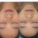 신정메디칼 | 수지구청 피부관리 올가드림뷰티 신정마을점 | 드림메디컬관리