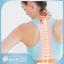 장수찬신경외과의원 네이버블로그
