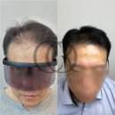 채오름SMP 이미지