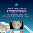 강남애프터치과 이미지