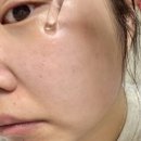앰플스위트 | 모공앰플 추천, 아크메르 화이트닝 앰플 사용 후기