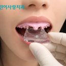 하이진치과의원 | 포항치과추천 찾고 계신다면, 오차를 줄이는 디지털 시스템이 있는지 확인해 보세요