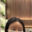 부산땅콩 | 땅콩형 얼굴 부산 관자필러로 진행 후기 !!땅콩형이 고민이신분들에게 추천!!!