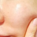 제이큐어 이미지