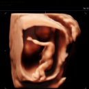 제법 | (임신 12주차 ) 초음파 후기, 이제 제법 사람 같아요!👶