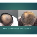 이지성형외과 이미지