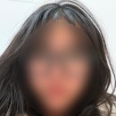 다인치과병원 | 턱뼈 하악골 골절 후기 ::1 악간고정술 치과대학병원수술