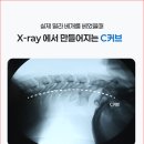 세일정형외과의원 | <네이버 넾다세일>거북목베개 추천, 정형외과 전문의가 설계한 경추베개 사용후기
